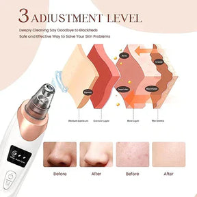 Electric Blackhead Remover Pore Vacuum Sucction machine - Sab Kharedo