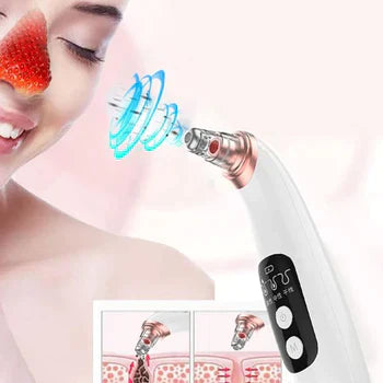 Electric Blackhead Remover Pore Vacuum Sucction machine - Sab Kharedo